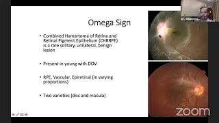 AIOS ARC Enhancing Concepts   OCT & OCT... Dr  VINOD KUMAR AGARWAL