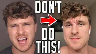 The Best Way To GET RID of Blind Pimples!