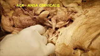 CERVICAL PLEXUS NECK Branches and Clinical Aspects – Sanjoy Sanyal