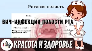 ВИЧ-инфекция полости рта