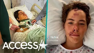 TikTok Star Caleb Coffee Survives  60-Foot Fall Off Of Cliff In Hawaii