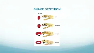 KNH-UoN Webinar : Clinical Management of Snakebites : A Syndromic Approach