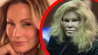 Botched Plastic Surgery That Ruined Celebrities Careers