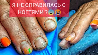 КЛИЕНТКА УШЛА😡😭И ВЕРНУЛАСЬ СПУСТЯ 2.5 МЕСЯЦА 🤯 ПРЕОБРАЖЕНИЕ НОГТЕЙ😍