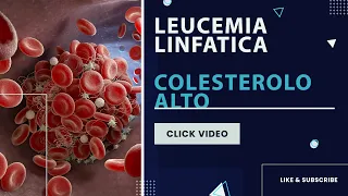 Leucemia linfatica cronica - Colesterolo alto