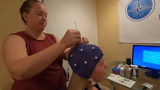 How to prepare for a Functional EEG and what to expect