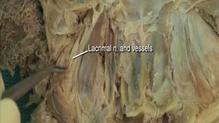 1.9 Step 3. Superior oblique muscle; trochlear and lacrimal nerves