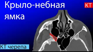 Лучевая анатомия крыловидно-небной ямки на КТ