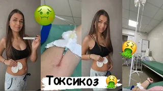 УЖАСНЫЙ ТОКСИКОЗ! 🤮 Как я спасалась от токсикоза|Мой первый триместр беременности 🤰🏼  #токсикоз