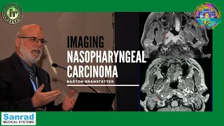 NASOPHARYNGEAL CARCINOMA IMAGING | DR BARTON BRANSTETTER | TUMOR STAGING