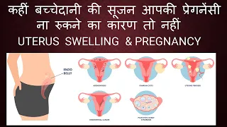 कहीं बच्चेदानी की सूजन आपकी प्रेगनेंसी ना रुकने का कारण तो नहीं / UTERUS SWELLING & GETTING PREGNANT