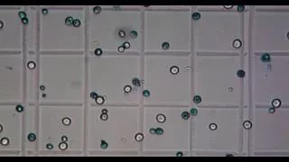 Counting Beer Yeast with Hemocytometer & Microscope - Part 2