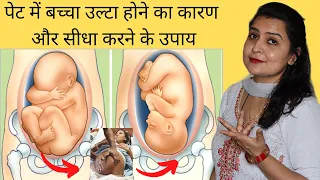 पेट में बच्चा उल्टा होने का कारण और सीधा करने के उपाय | Causes of Breech Baby| My Pregnancy Care