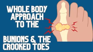 Bunions, Crooked Toes - The Whole Body Feldenkrais® Approach