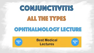 Conjunctivitis(Pink Eye) in the eye lecture - Symptoms, Treatment, Types