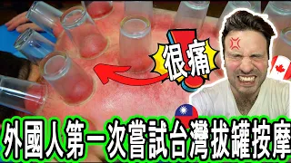 I Tried Taiwan's PAINFUL Cupping Therapy So You Don't Have To - How Bad Is It?