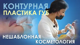 Контурная пластика губ, решаться на процедуру или нет?