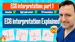 #ecg interpretation : The animated Visual Guide with ECG Criteria #electrocardiogram