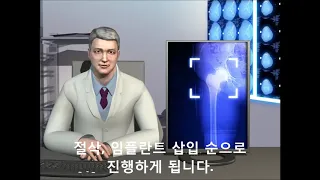 [큐렉소] 인공관절수술로봇 ROBODOC(Hip)