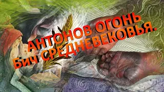 Чем болели в Средневековье Ведьмина корча, Антонов огонь. Отравление Спорыньей. Эрготизм