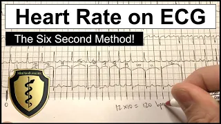 ECG Heart Rate Calculation - The Six Second Method!