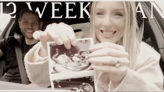 OUR 12 WEEK BABY SCAN