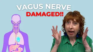 You Won't Believe The Latest: Vagus Nerve Damage Confirmed in Long COVID