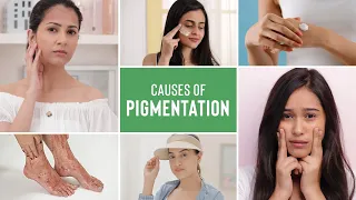 What Is Pigmentation On Face & What Are The Causes Of Pigmentation | Cosmetologist Explains