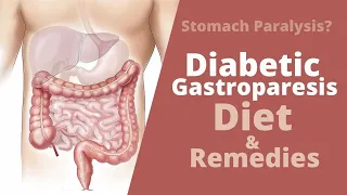 Diabetic Gastroparesis - Diet  Modifications, Causes and Treatment