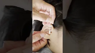 🇻🇳Ear cleaning67  #shorts