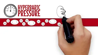 Simple Explainer Video on How Hyperbaric Oxygen Therapy Works.  Best Method.