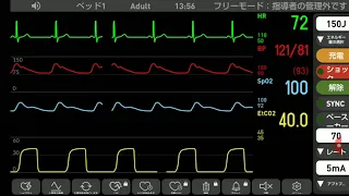 心電図モニター シュミレーション　安定