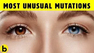 10 Unusual Genetic Mutations Of The Human Body