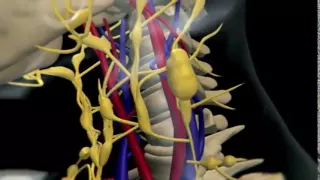 How Lymphoma Develops