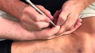 Intense hand massage using tools. Part 9 of Brandon massaging Dave’s hand.