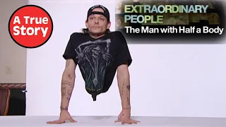 The Man With Half A Body: The FULL Documentary | A True Story