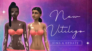 New Sims 4 Vitiligo Update FREE