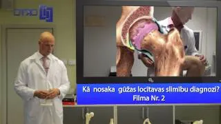 Kā nosaka gūžas locītavas slimību diagnozi? Filma Nr  2