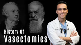 History of Vasectomies