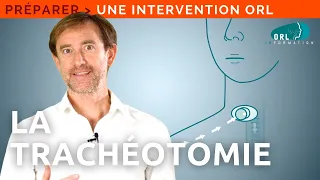 Patient's information | Tracheotomy