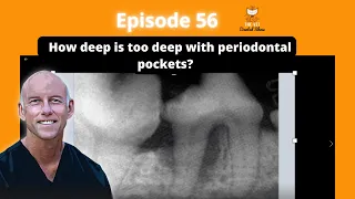 Ep 56 -  How deep is too deep with periodontal pockets?