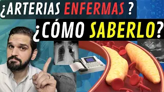 !INTERESANTE¡ Exámenes para saber SI TENGO las ARTERIAS del corazón ENFERMAS 😲