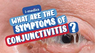 What are the Symptoms of Conjunctivitis?👨‍⚕️🩺