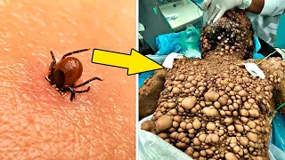 15 Insectos Con Las Picaduras Más VENENOSAS Del Mundo 😨