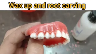 #wax up #carving and #festooning of Complete Denture #dentistry #dentures