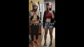 Two Year HRTanniversary! - Ultimate Transition Timeline