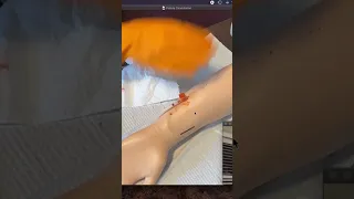 AV Fistula Needle Insertion Cannulation Demo/Procedure