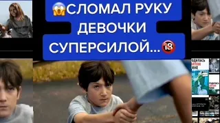 СЛОМАЛ РУКУ ДЕВОЧКИ СУПЕРСИЛОЙ. Название фильма: "Гори, гори, ясно"