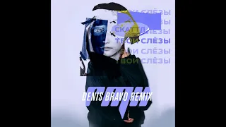 Скаттл - Твои Слёзы (Denis Bravo Remix)