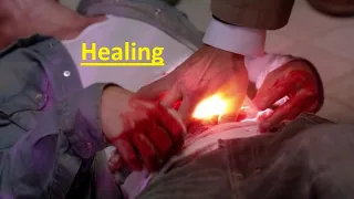 Supernatural Powers Healing